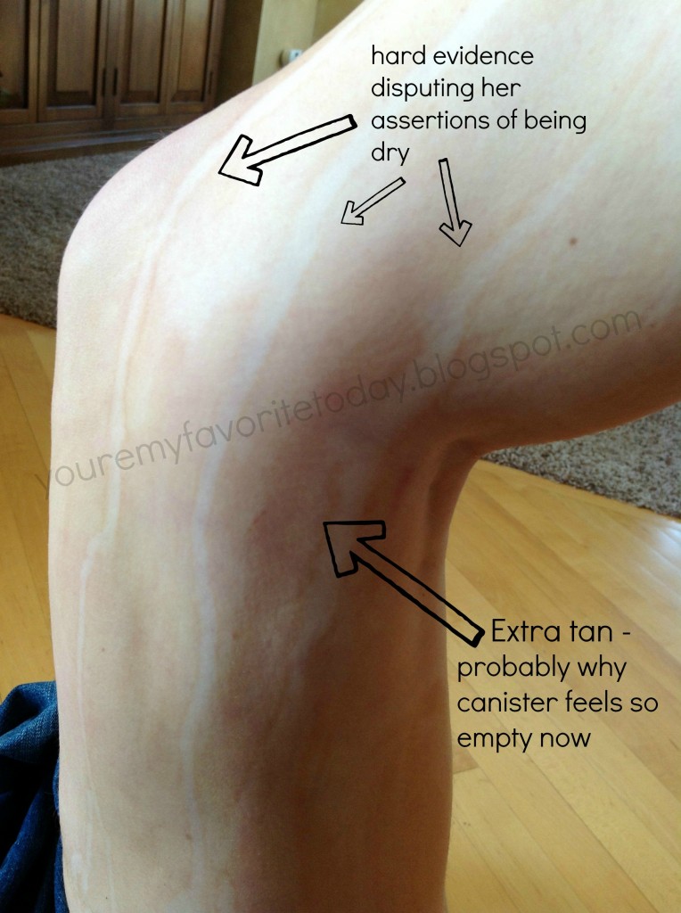 tanner knee